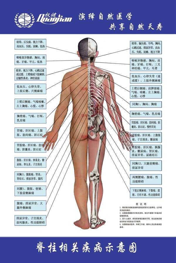 脊柱相关疾病示意图