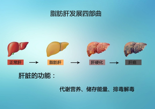 脂肪肝进化步骤