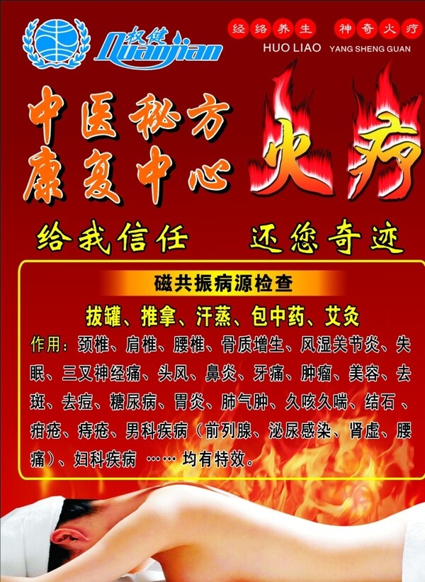 火療宣傳單