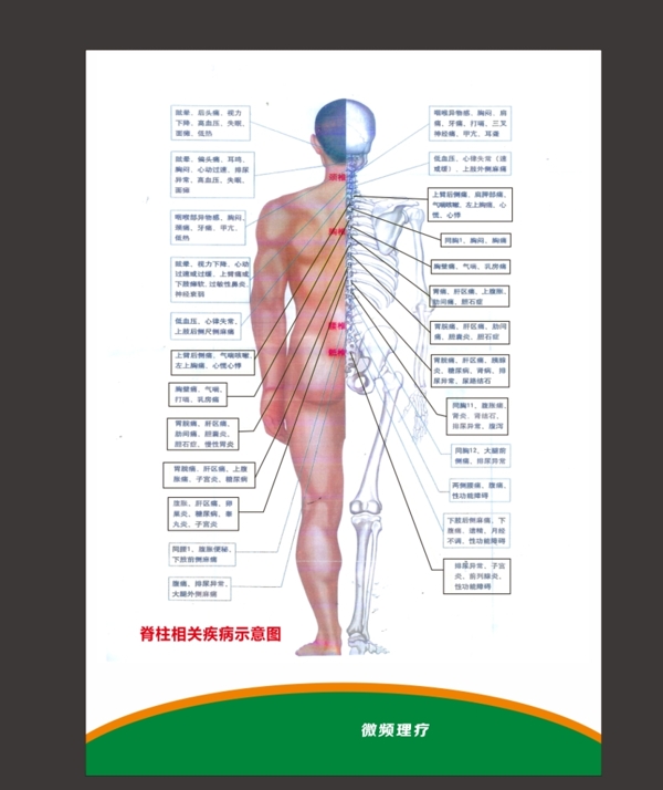 人体脊柱图片