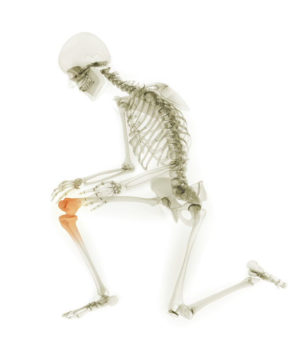 人体膝关节X光透视图图片