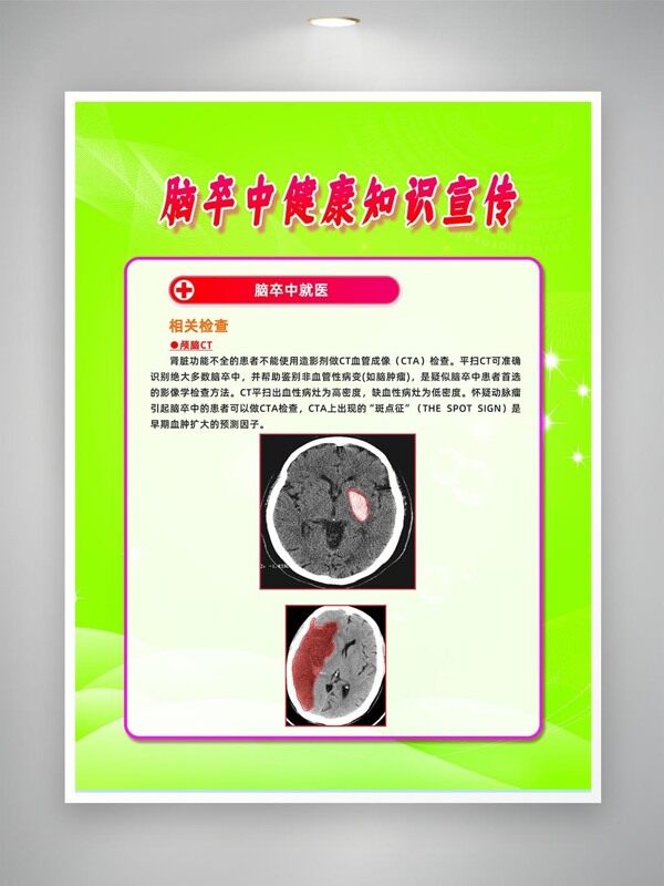 腦卒中相關(guān)檢查科普宣傳海報