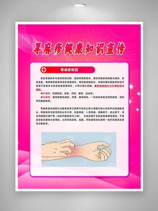 蕁麻疹病因科普知識宣傳海報
