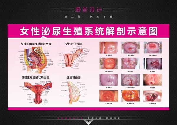 女性泌尿解剖示意图