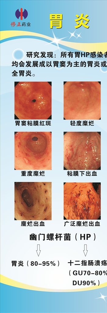 修正胃炎海报展架易拉宝