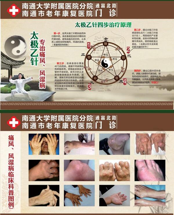 中医疗法图片