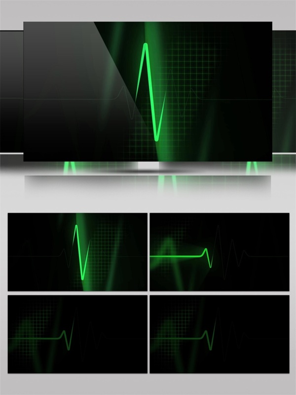 绿色闪电光束视频素材