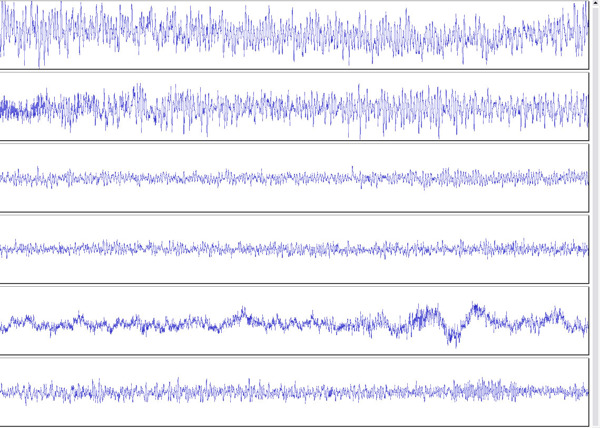 脑病图Encephalograph医疗设备