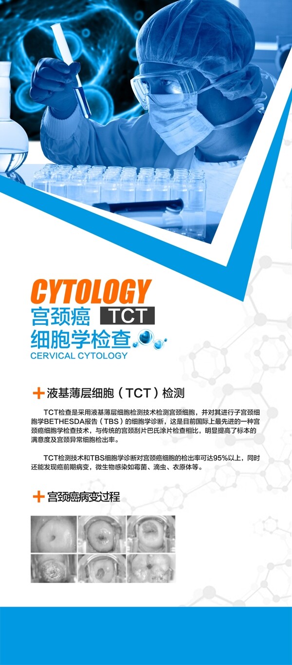 宫颈癌细胞学检查X展架