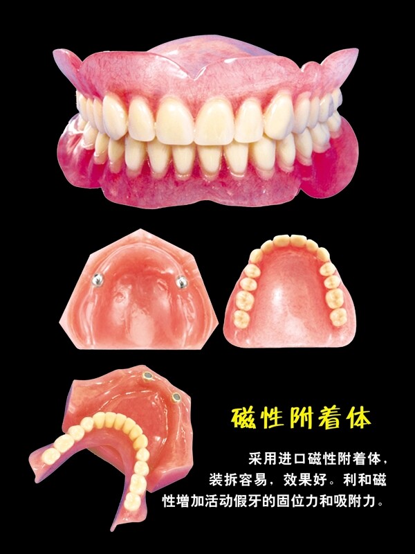 磁性附着体牙科