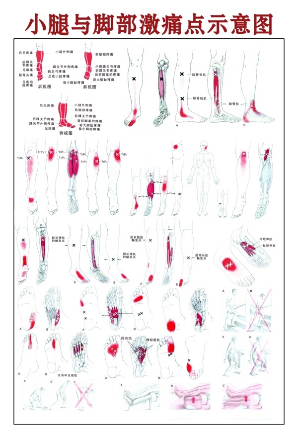 小腿与腿部激痛点示意图