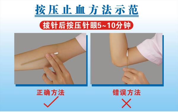 止血方法